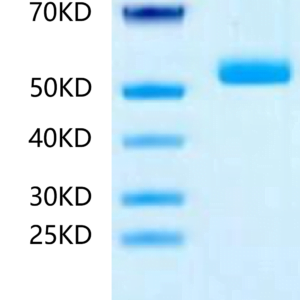 SDS-PAGE gel of Human IL-23 P19/IL-23A?Protein 2420