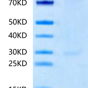 SDS-PAGE gel of Human Integrin alpha 8 beta 1 (ITGA8&ITGB1) ?Heterodime 2421