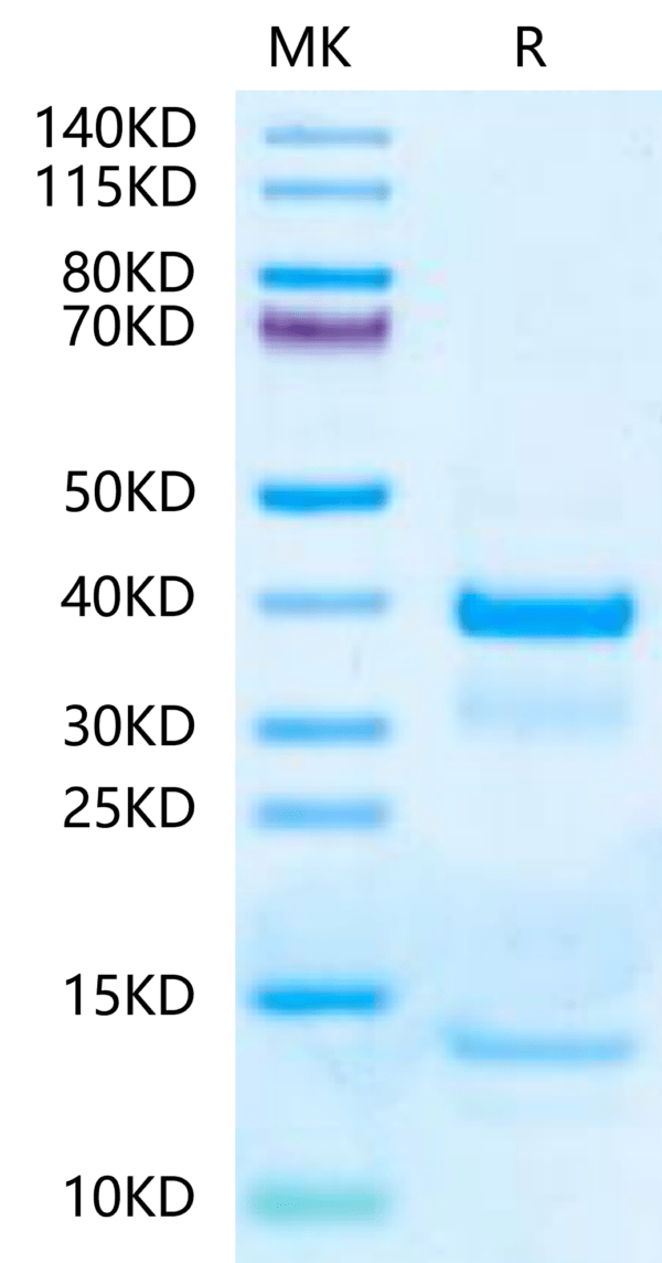 SDS-PAGE gel of Mouse tPA?Protein 2424