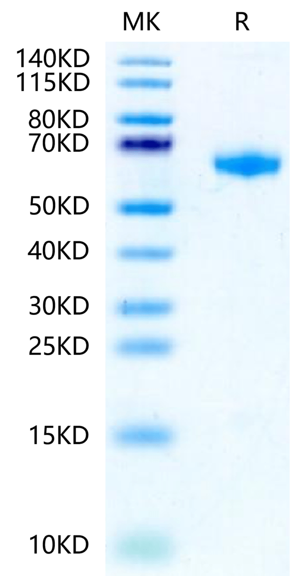 SDS-PAGE gel of Rat IL-22R alpha 1 Protein 2428