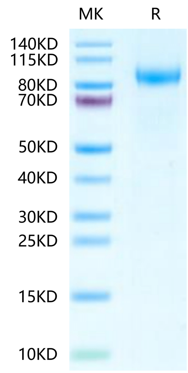 SDS-PAGE gel of Mouse VCAM-1/CD106 Protein 2435