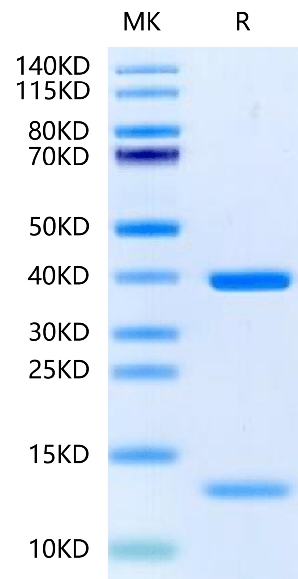 SDS-PAGE gel of Biotinylated Human HLA-A*11:01&B2M&KRAS G12D (VVGADGVGK 2439