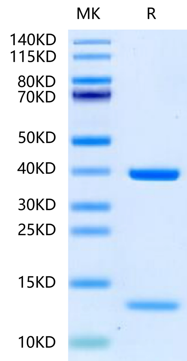 SDS-PAGE gel of Biotinylated Human HLA-A*11:01&B2M&KRAS G12D (VVVGADGVG 2441