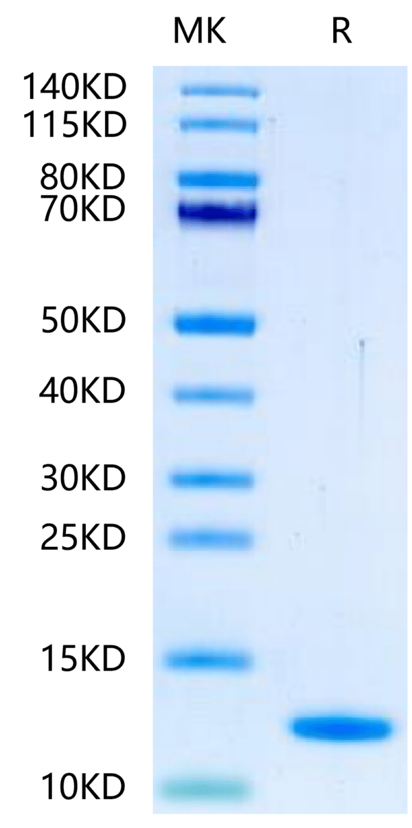 SDS-PAGE gel of Human BLOC1S2?Protein 2454