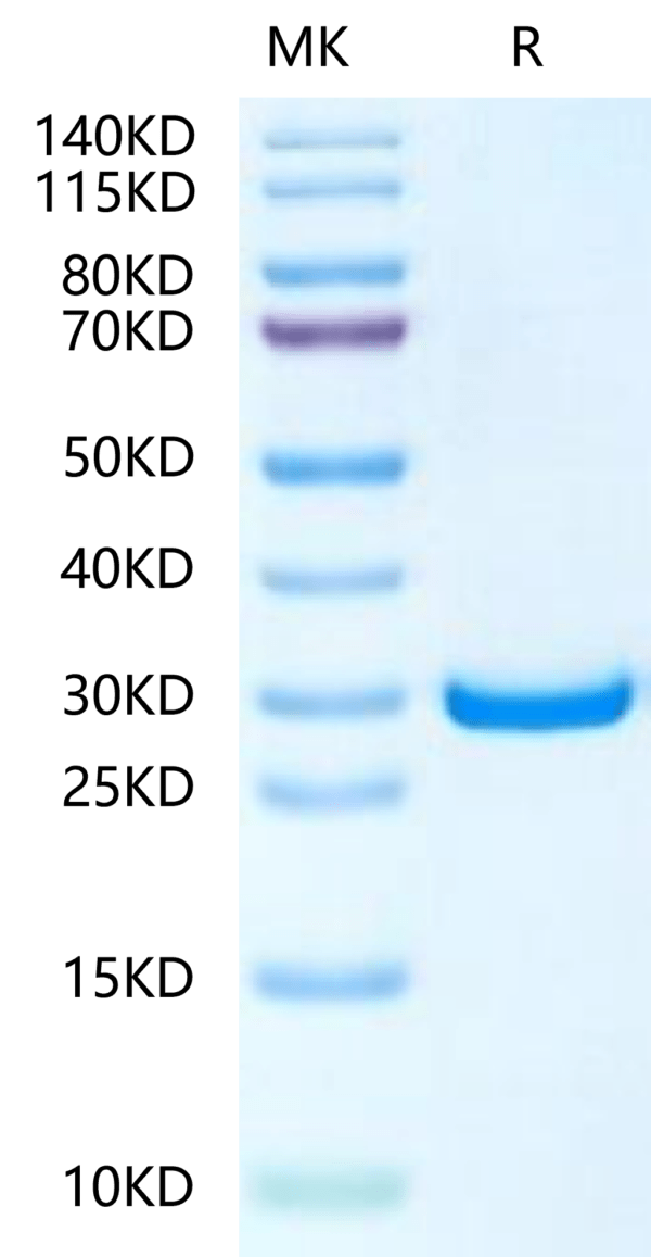 SDS-PAGE gel of Human PHOSPHO1?Protein 2460