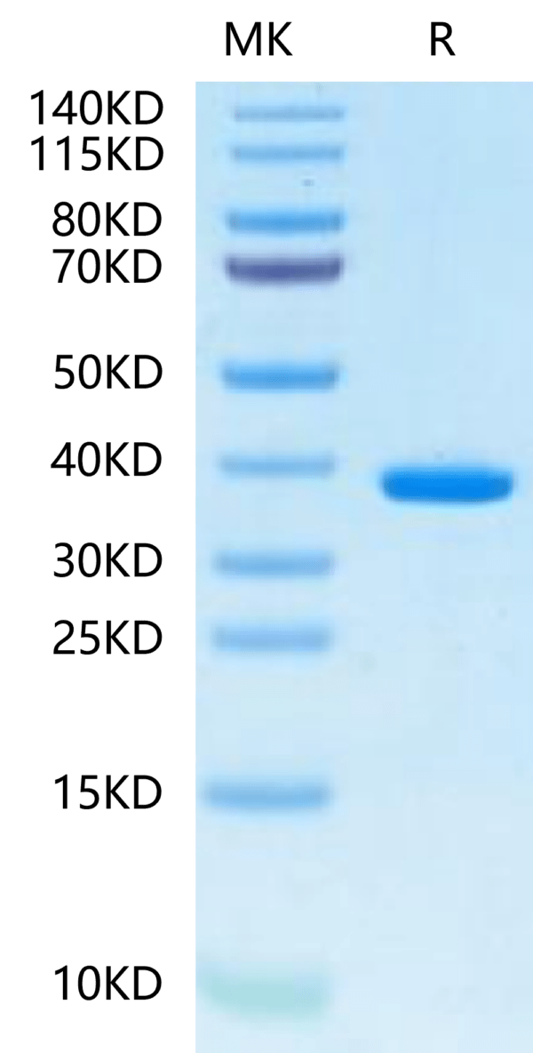 SDS-PAGE gel of Human FDPS?Protein 2465