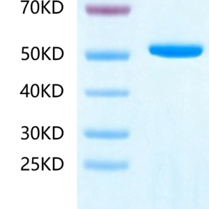 SDS-PAGE gel of Human Adenylosuccinate Lyase?Protein 2466