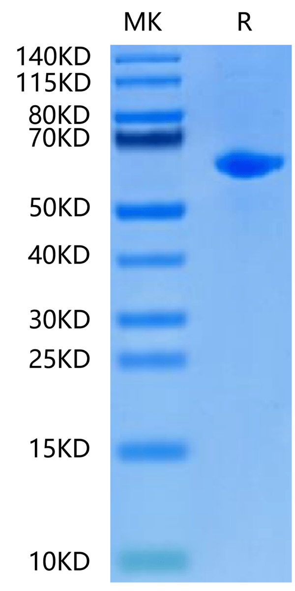 SDS-PAGE gel of Rat Alkaline Phosphatase (Germ type) /ALPG Protein 2484