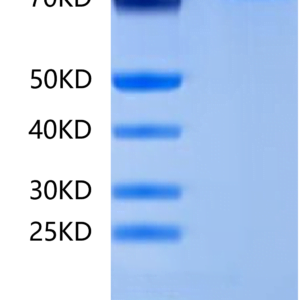 SDS-PAGE gel of Mouse BCHE/Butyrylcholinesterase Protein 2485