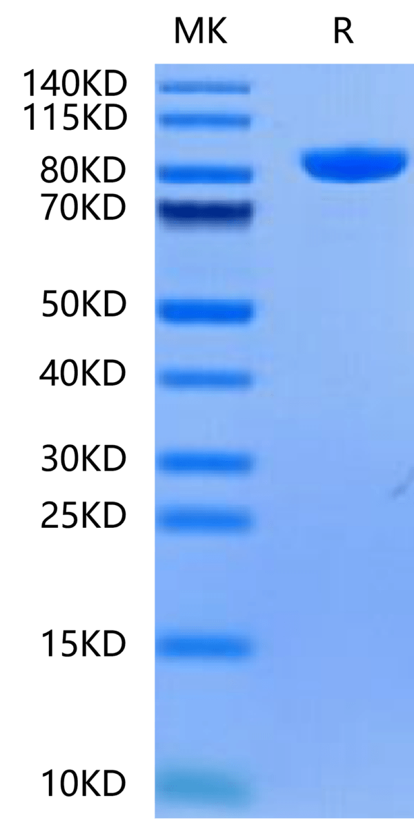 SDS-PAGE gel of Human Alkaline Phosphatase (Germ type) /ALPG Protein 2490