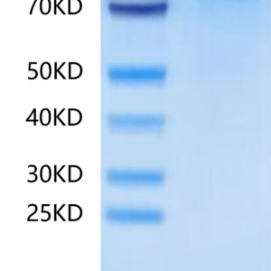 SDS-PAGE gel of Human BCHE/Butyrylcholinesterase?Protein 2505