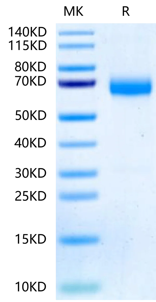 SDS-PAGE gel of Human ANGPTL3/Angiopoietin-like 3 Protein 2517