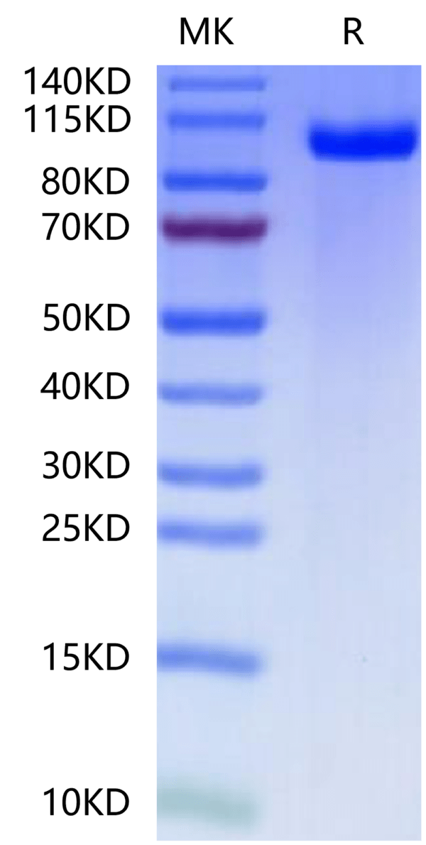 SDS-PAGE gel of Mouse PTK7/CCK4 Protein 2519