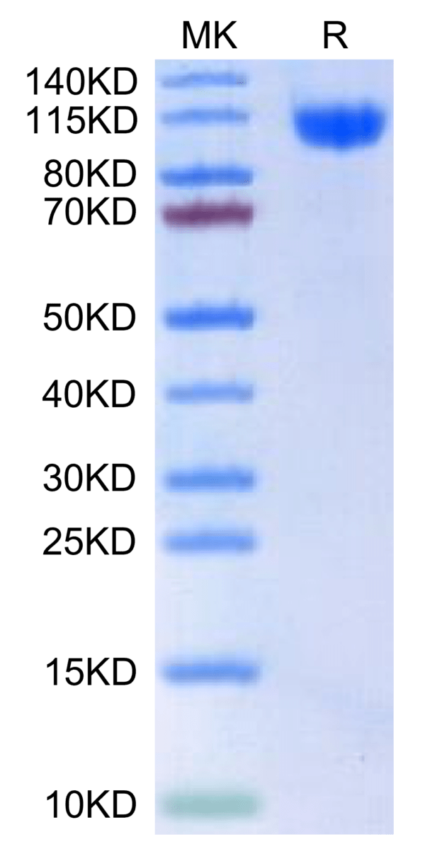 SDS-PAGE gel of Human RET?Protein 2522