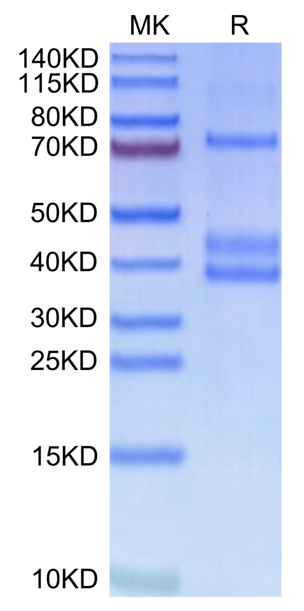 SDS-PAGE gel of Human MSPR/Ron?Protein 2523