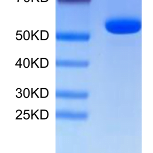 SDS-PAGE gel of Human Hyaluronidase 2/HYAL2?Protein 2524