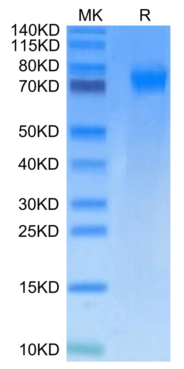 SDS-PAGE gel of Mouse PDGF R alpha/PDGFRA Protein 2531