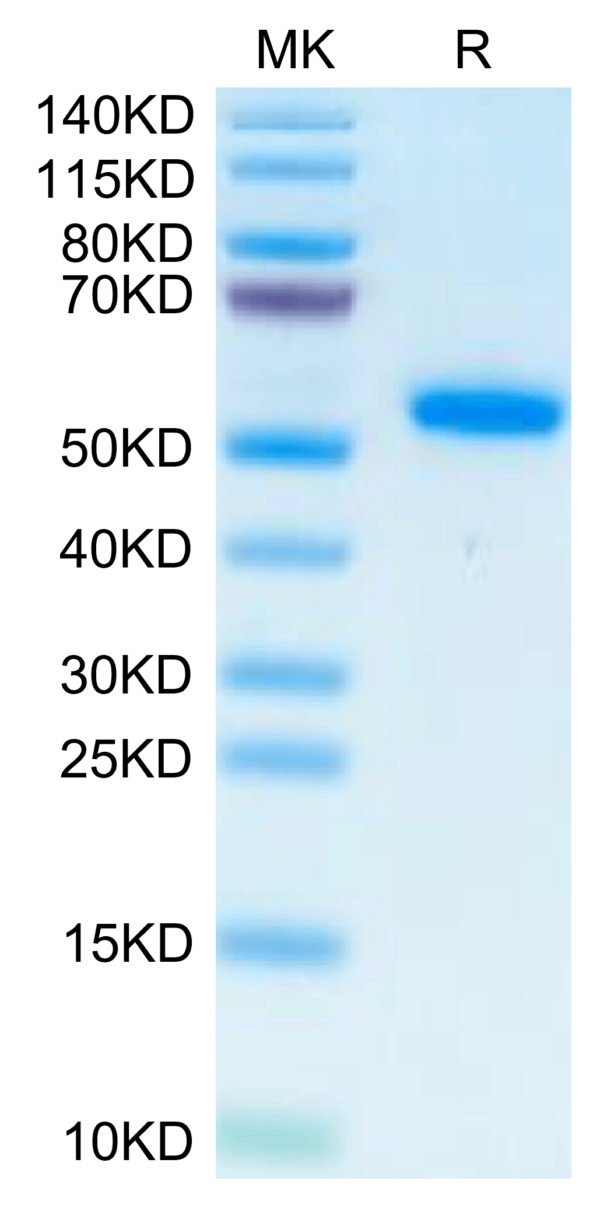 SDS-PAGE gel of Human IL-17B Protein 2534