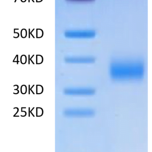 SDS-PAGE gel of Human CD72 Protein 2543