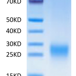 SDS-PAGE gel of Human TDGF1/Cripto Protein 2546