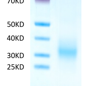 SDS-PAGE gel of Human CD37 Protein 2555