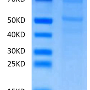 SDS-PAGE gel of Human CDH6/Cadherin-6 Protein 2559