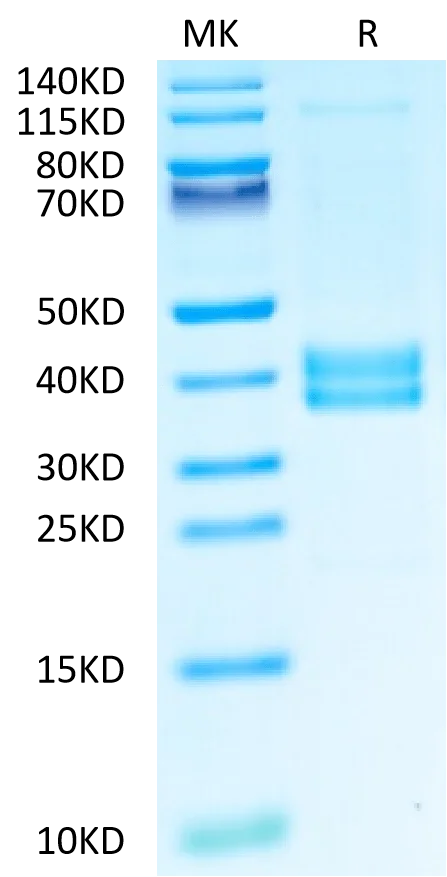 SDS-PAGE gel of Human HLA-DRA*01:01&HLA-DRB1*15:01&Hemagglutinin (PKYVK 2581