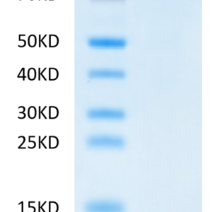 SDS-PAGE gel of Human Jagged 1/JAG1 Protein 2591