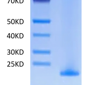 SDS-PAGE gel of Human MD2 Protein 2610