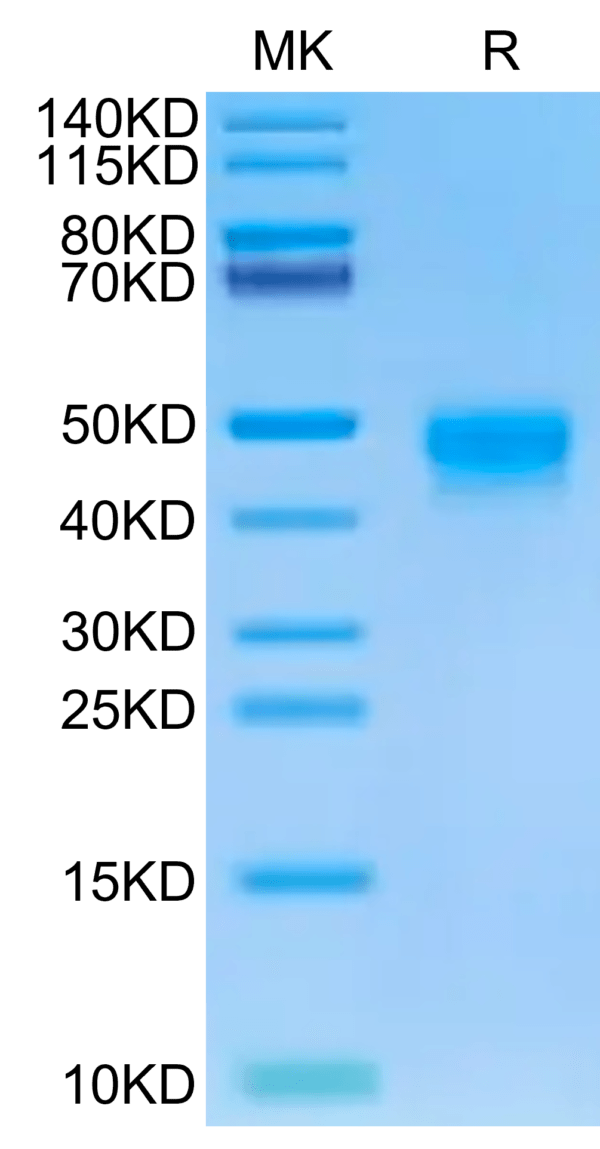SDS-PAGE gel of Human DKK1 Protein 2629