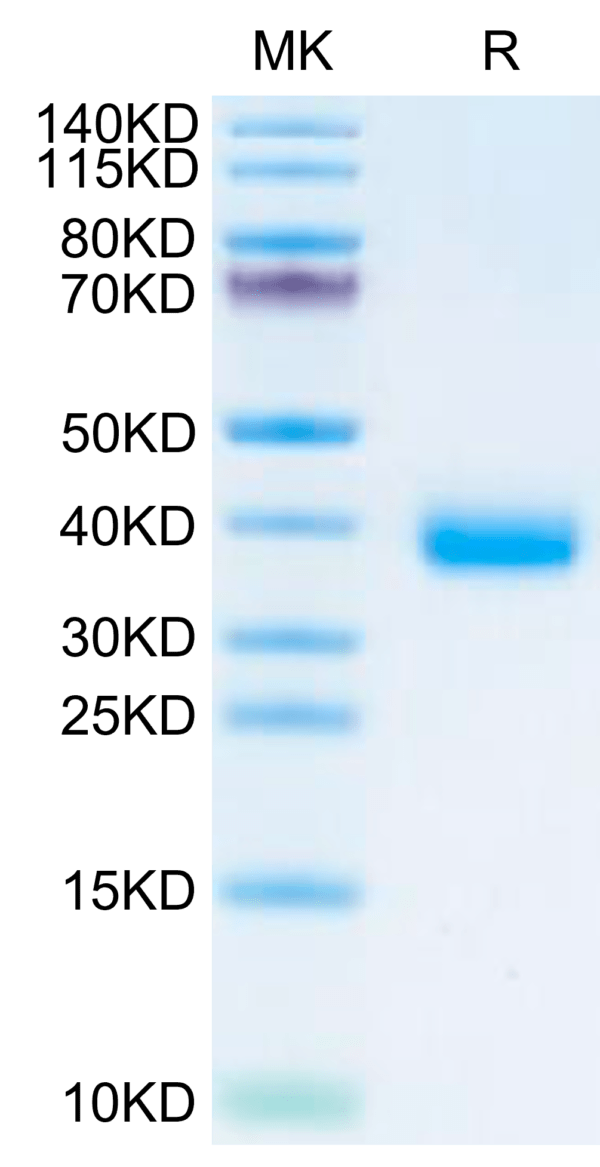 SDS-PAGE gel of SARS-CoV-2 Spike RBD (Omicron BA.2.75.2) Protein 2633