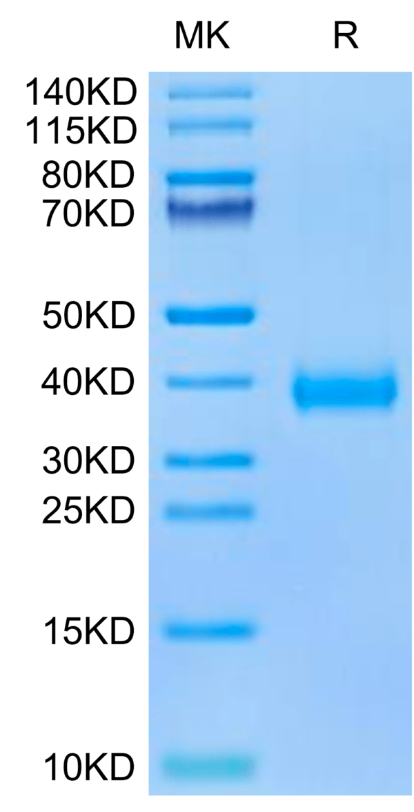 SDS-PAGE gel of SARS-CoV-2 Spike RBD (Omicron BA.2.75) Protein 2634