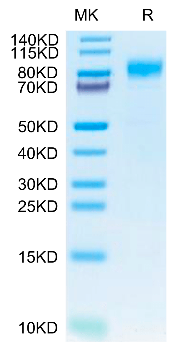 SDS-PAGE gel of Canine PDGF R beta/CD140b Protein 2637