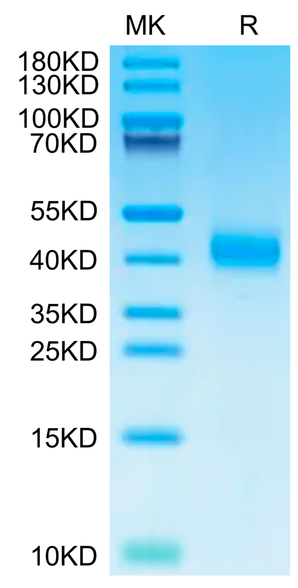 SDS-PAGE gel of Human ASGR1 Protein 2647