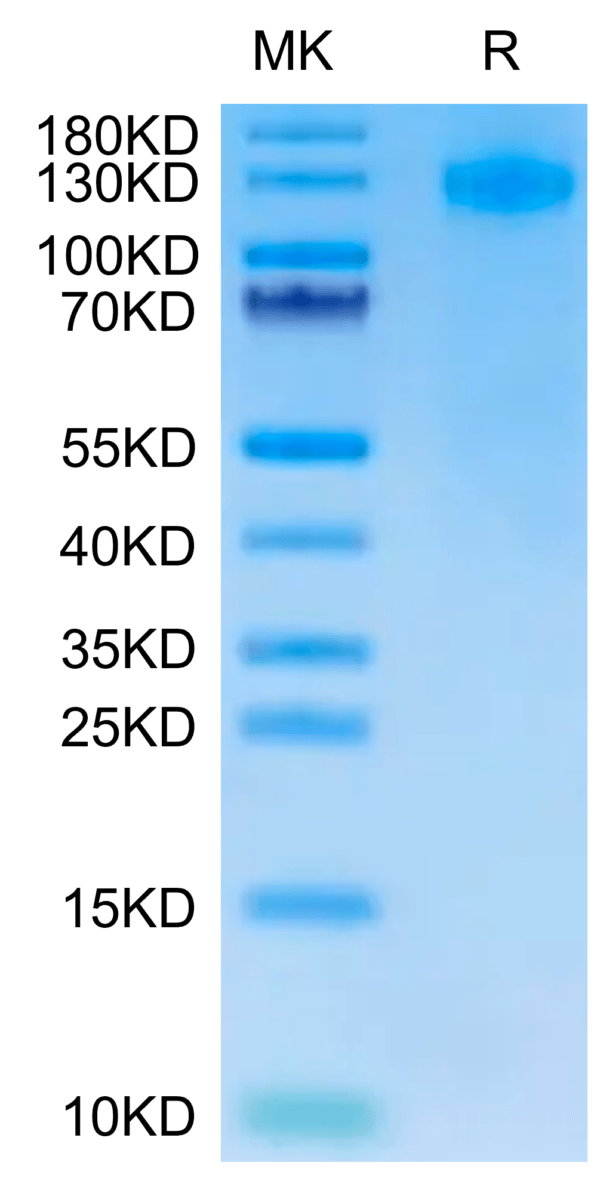 SDS-PAGE gel of Human FcRH5/FcRL5 Protein 2648