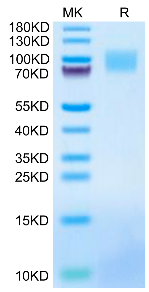 SDS-PAGE gel of Mouse GUCY2C/Guanylyl cyclase C Protein 2650