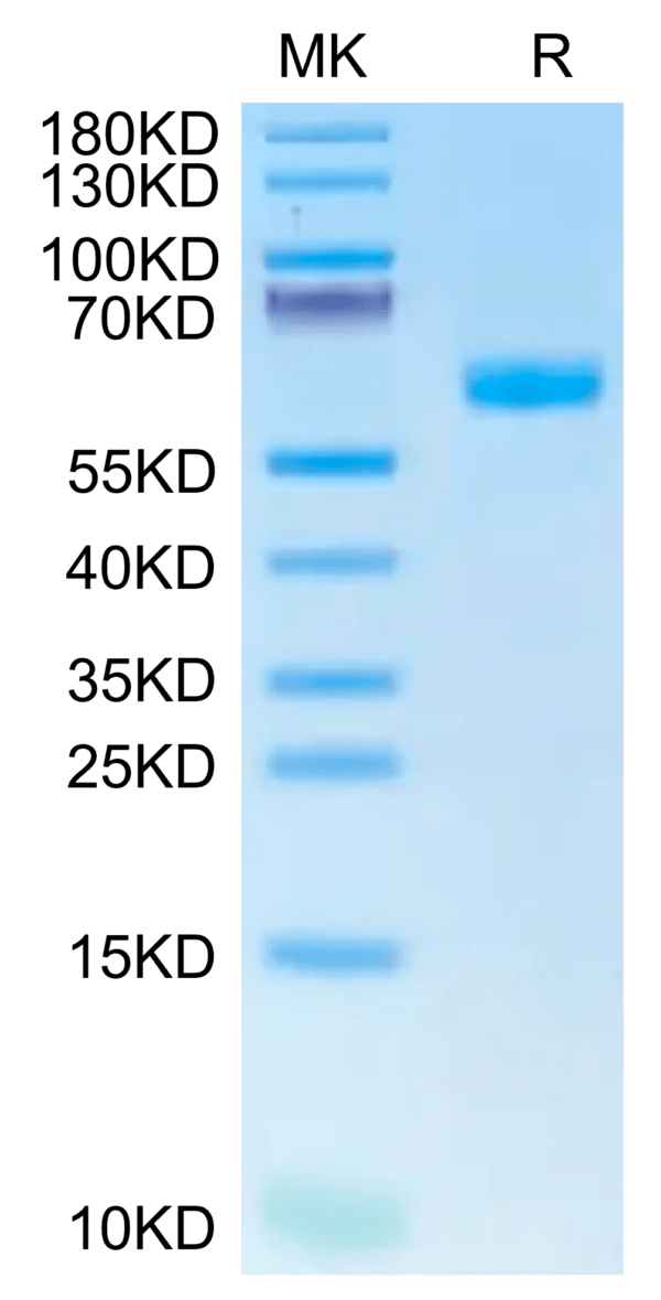 SDS-PAGE gel of Human CDH17/Cadherin 17 Domain 6-7 Protein 2651