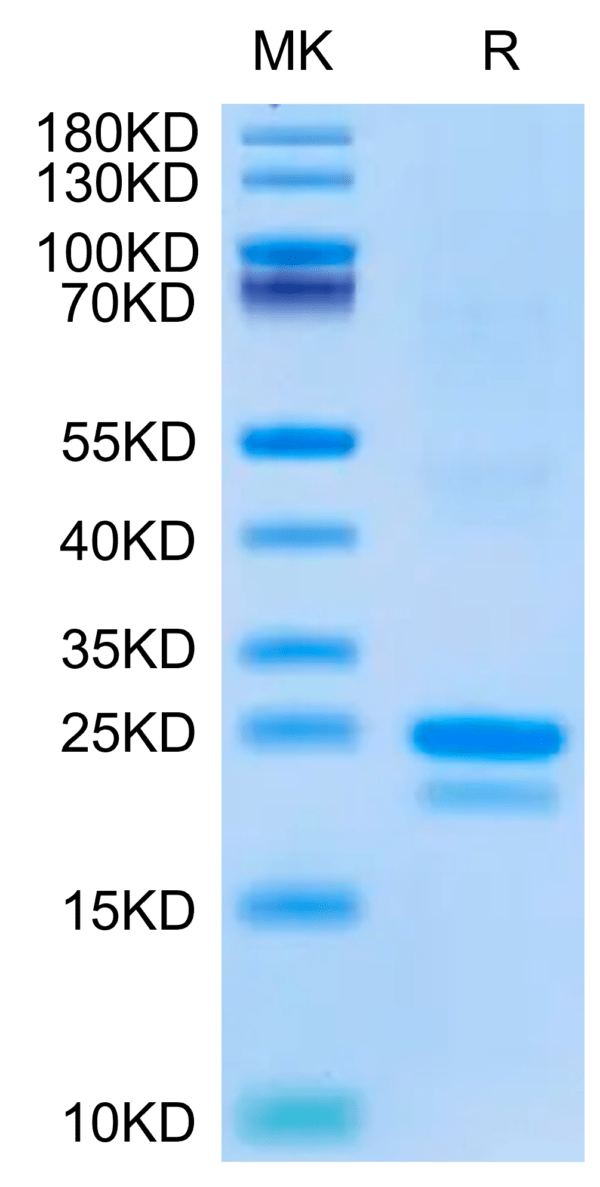 SDS-PAGE gel of Mouse SP17 Protein 2656