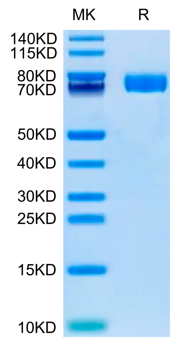 SDS-PAGE gel of Human Fibronectin (32-602) Protein 2658