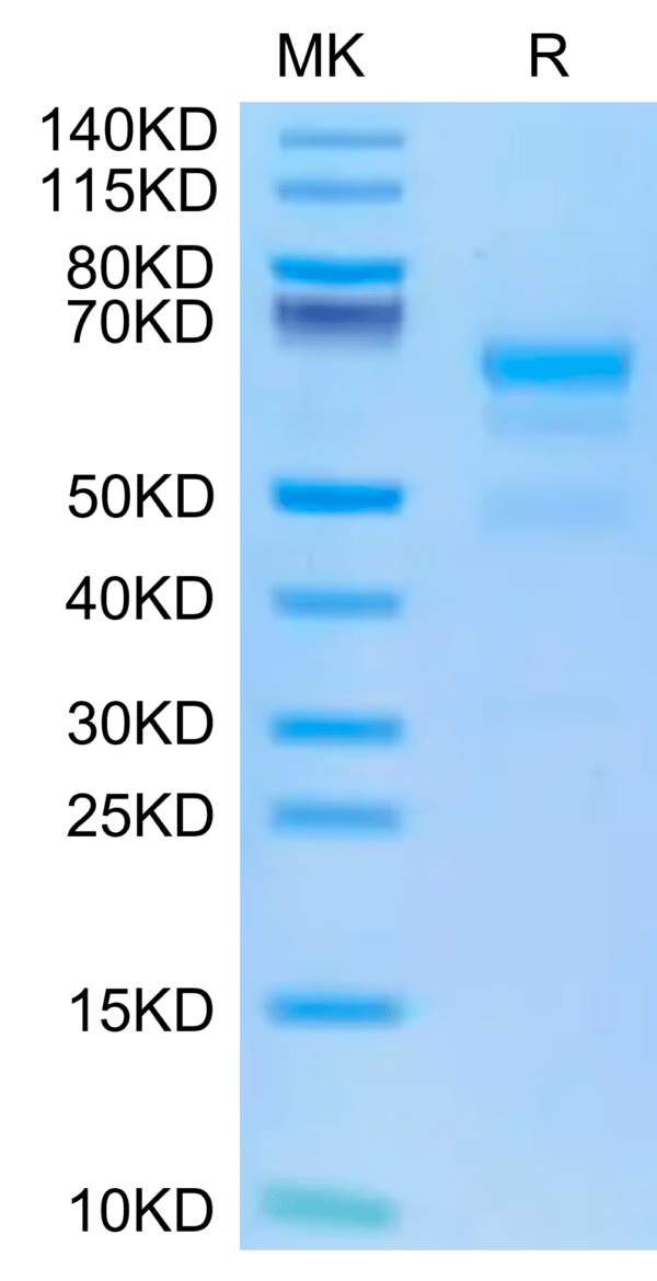 SDS-PAGE gel of Human ULBP-4 Protein 2661