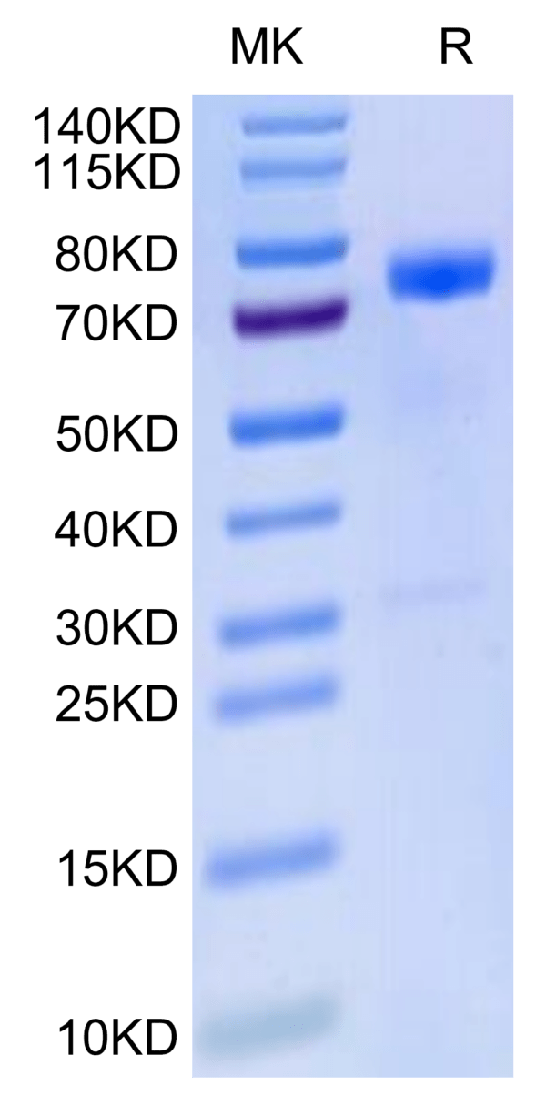 SDS-PAGE gel of Human MICB Protein 2679