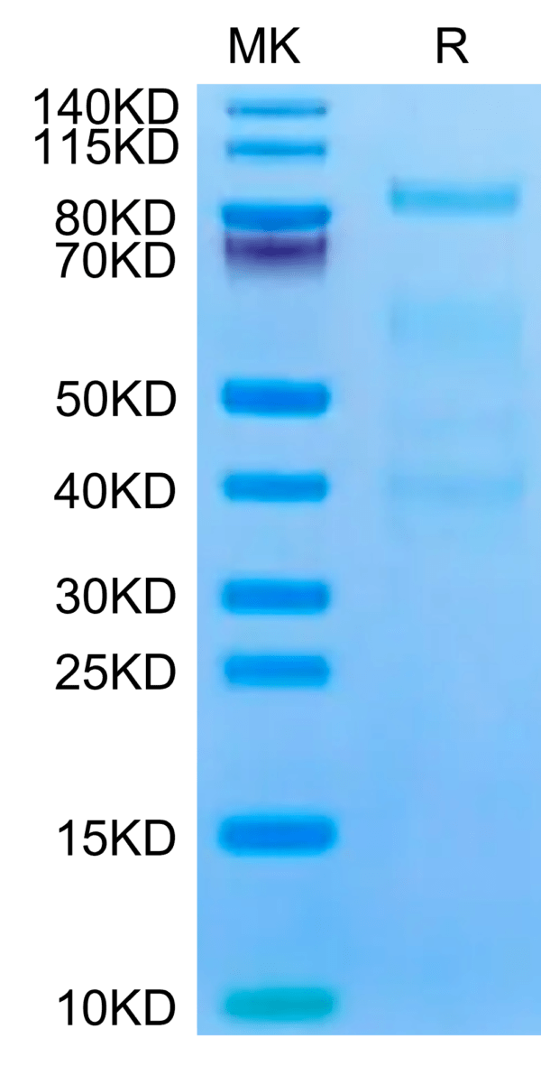 SDS-PAGE gel of Mouse Complement factor I Protein 2698