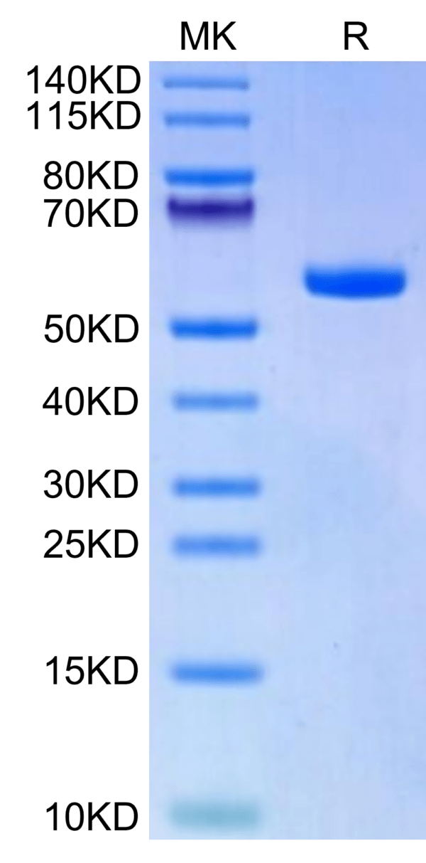 SDS-PAGE gel of Biotinylated Human HLA-A*11:01&B2M&KRAS G12A (VVVGAAGVG 2701