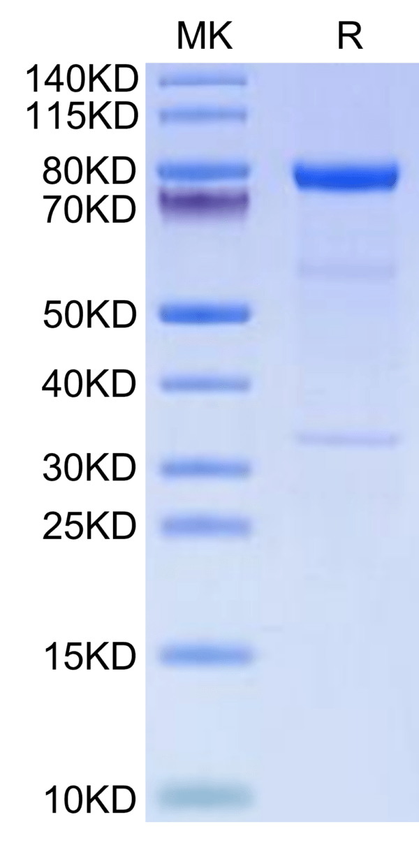 SDS-PAGE gel of Human Complement Component C1s Protein 2703