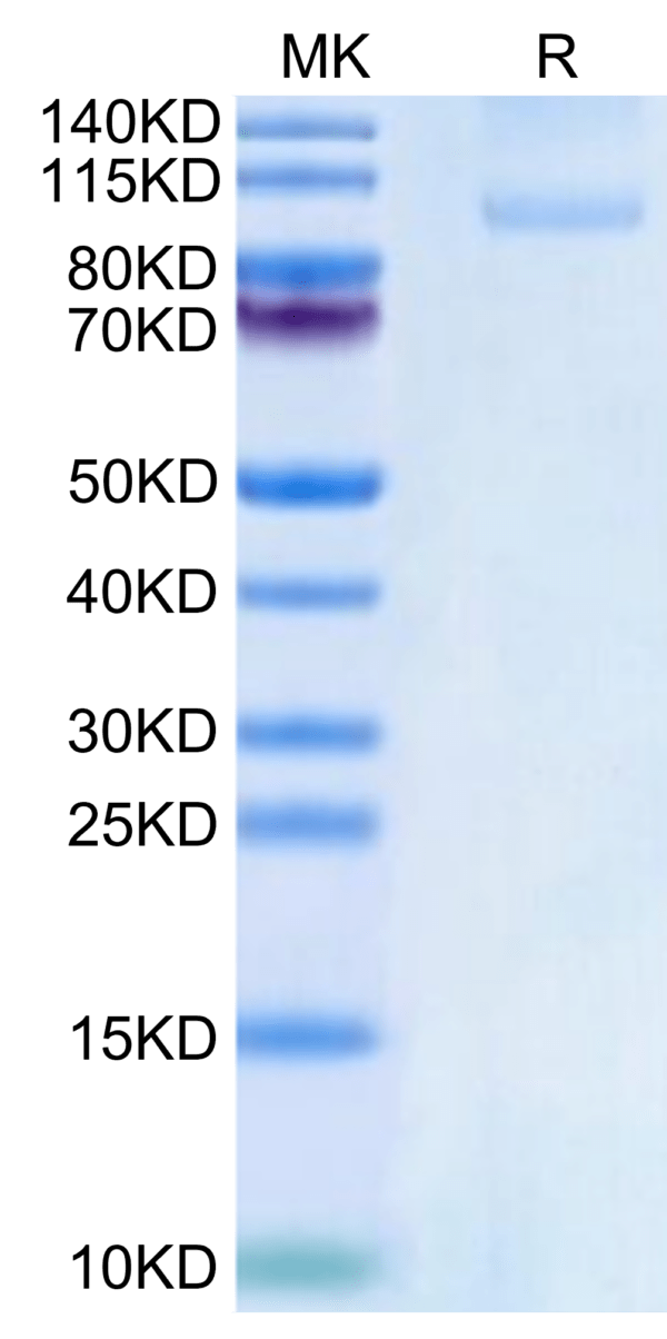 SDS-PAGE gel of Rhesus macaque CDH17/Cadherin 17 Protein 2704