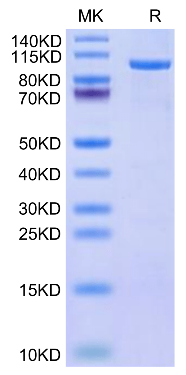 SDS-PAGE gel of Human CDH19 Protein 2706