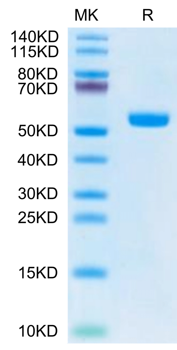 SDS-PAGE gel of Biotinylated Human HLA-A*02:01&B2M&MAGE-A4 (KVLEHVVRV)  2708