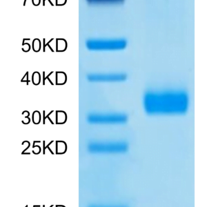SDS-PAGE gel of Human MBL2/Mannan Binding Lectin Protein 2714