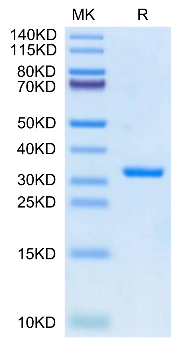 SDS-PAGE gel of SARS-CoV-2 3CLpro/3C-like Protease Protein (E166V)  2715