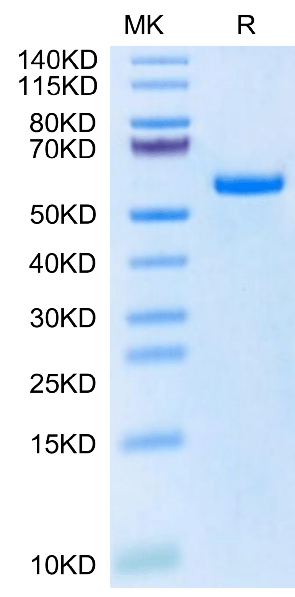 SDS-PAGE gel of Biotinylated Human HLA-A*11:01&B2M&KRAS G12S (VVVGASGVG 2716